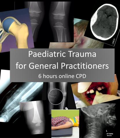 Paediatric Trauma for GPs